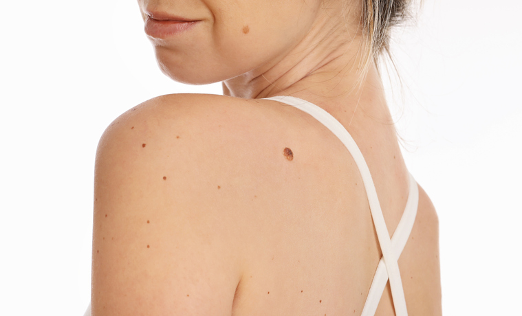 Dermatologie